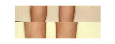 251 üzleti kép ZSÍRLESZÍVÁS KLINIKA DR LÁNYI CECÍLIA Plasztikai sebészet ban/ben Budapest