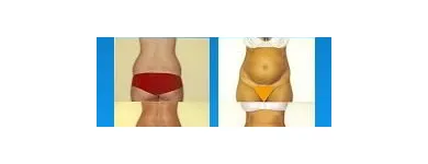 258 üzleti kép ZSÍRLESZÍVÁS KLINIKA DR LÁNYI CECÍLIA Plasztikai sebészet ban/ben Budapest