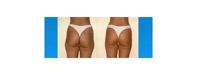 259 üzleti kép ZSÍRLESZÍVÁS KLINIKA DR LÁNYI CECÍLIA Plasztikai sebészet ban/ben Budapest